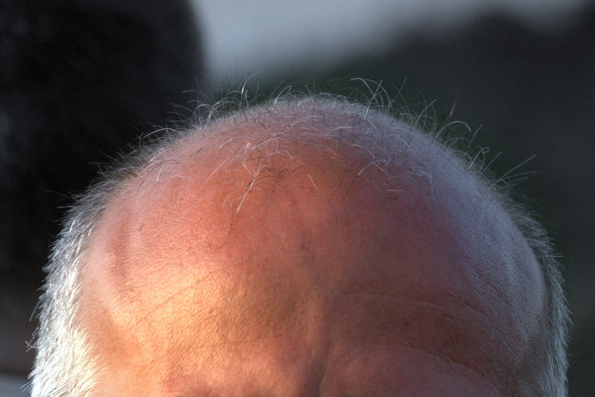 法官英明？英國勞工法庭判決：罵男人禿頭構成性騷擾